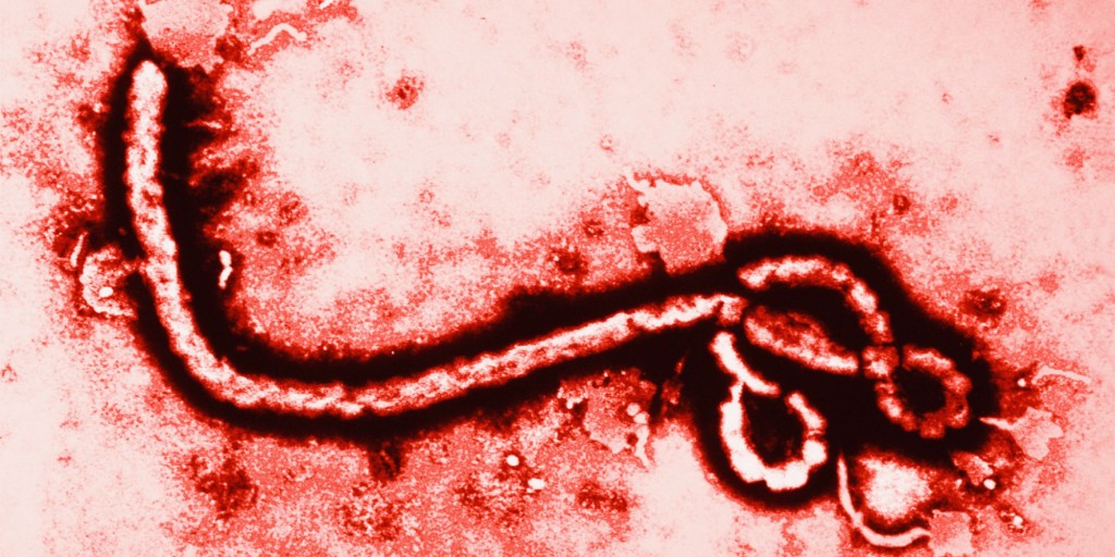 Ebola Virus at 108,000 Magnification - Crédit photo : huffingtonpost.com